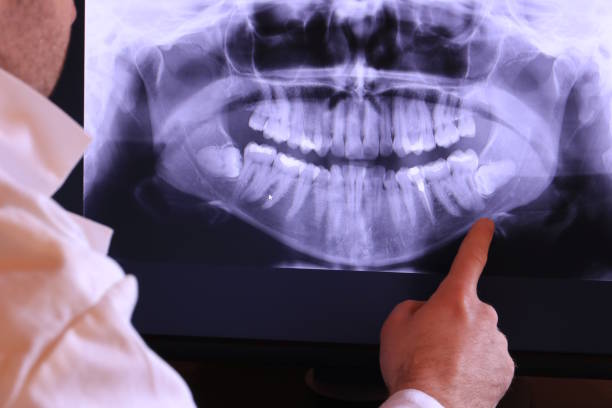 Best Emergency Dentist for Knocked-Out Tooth in World Golf Village, FL